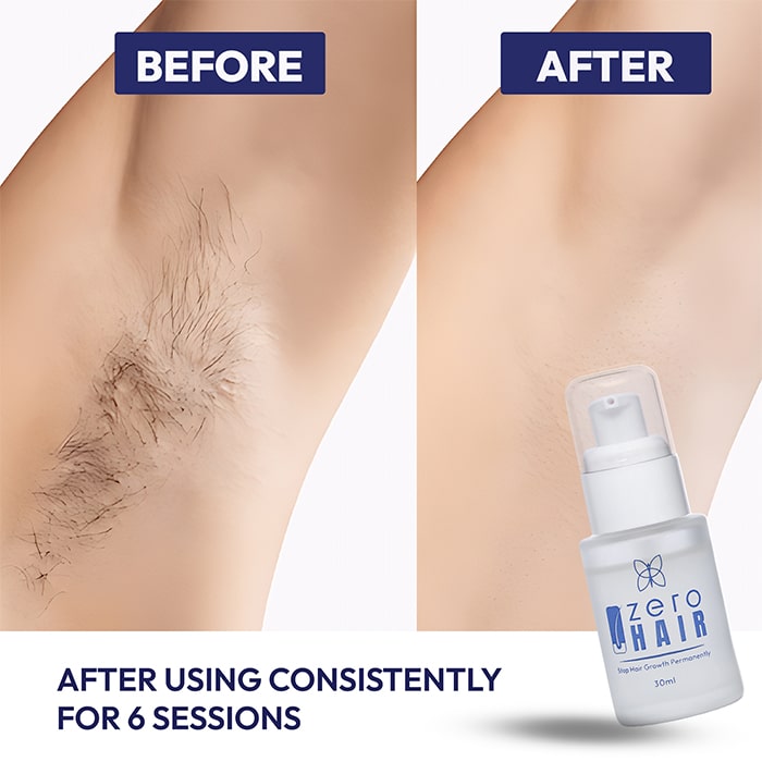 ZERO HAIR SERUM Permanent Hair Removal