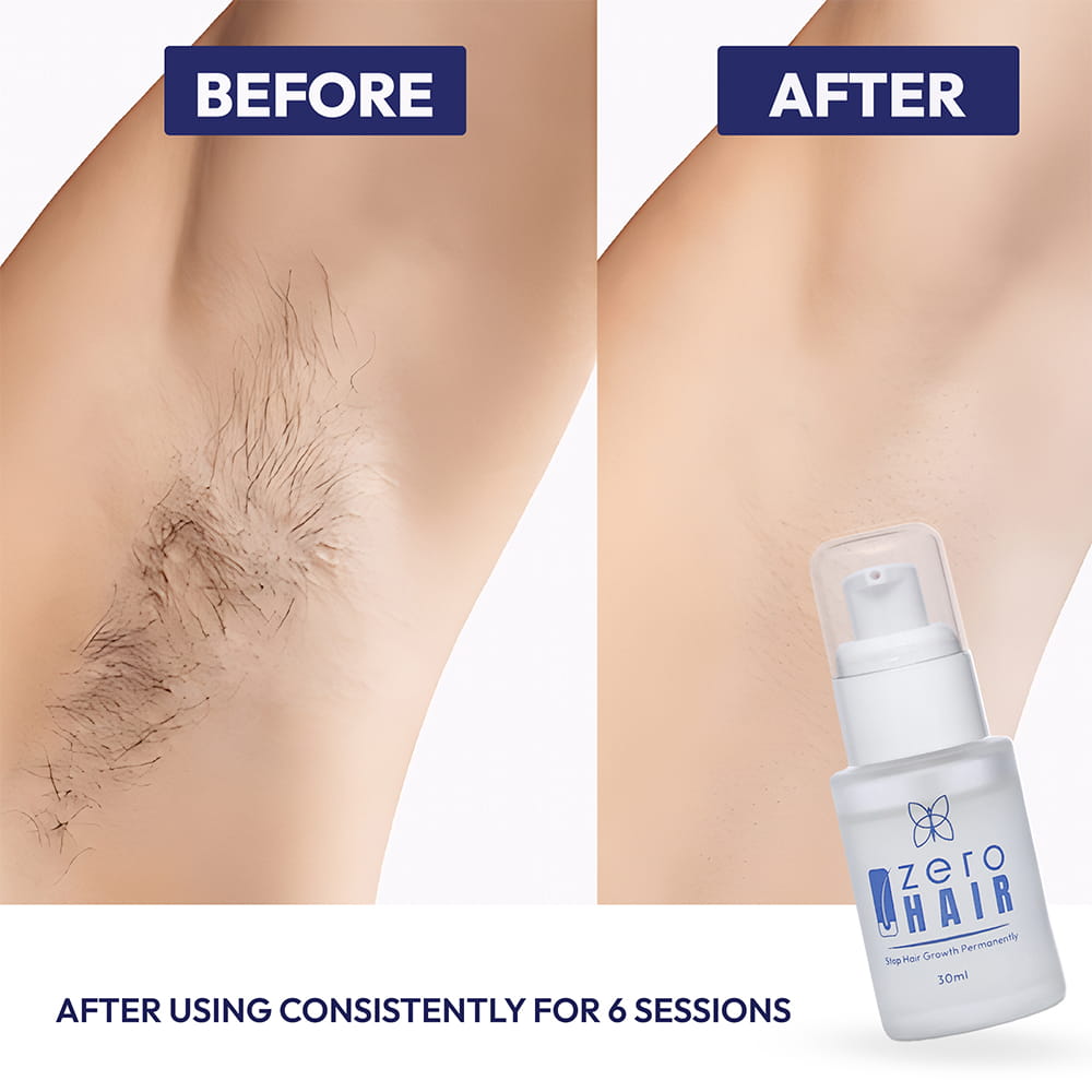 ZERO HAIR SERUM