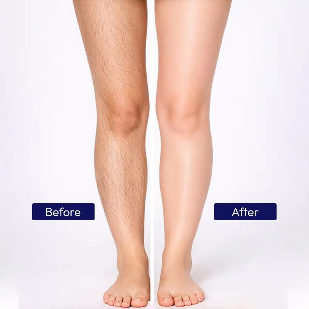 Zaisha Permanent Hair Removal Kit - Jumbo Deal - ZAISHA