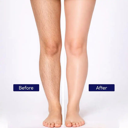 Zaisha Permanent Hair Removal Kit - Jumbo Deal - ZAISHA
