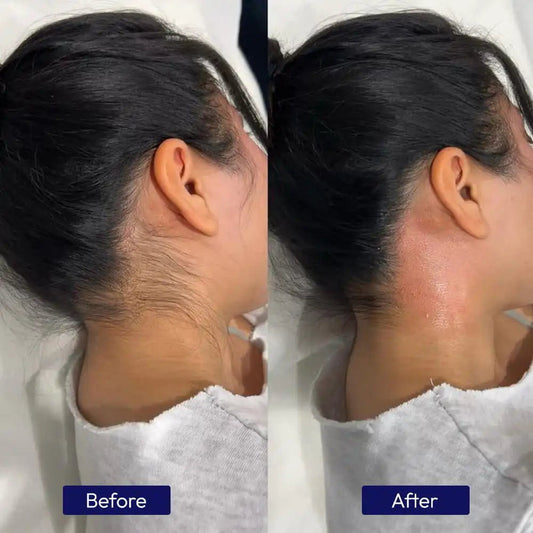 ZERO HAIR SERUM - ZAISHA