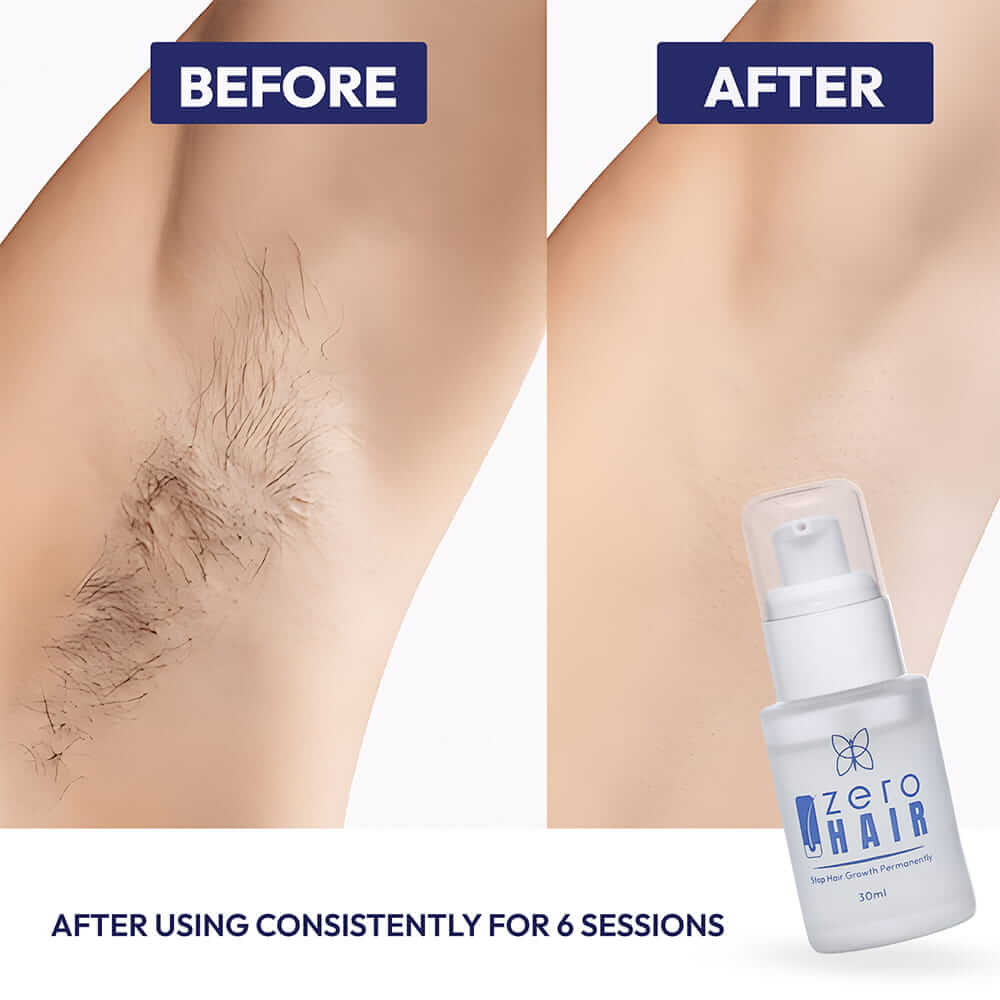 Zero Hair Serum + Free Lotion - ZAISHA